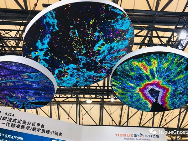 TissueGnostics公司2020慕尼黑上海剖析生化展圆满收官！-江西省立康科技有限公司